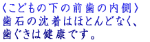 A�q����i�R�΁j ���Ǝ��̊Ԃɂނ����͂���܂���B 